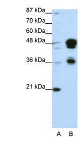 FOXA1 Antibody - FOXA1 antibody Western blot of Transfected 293T cell lysate. This image was taken for the unconjugated form of this product. Other forms have not been tested.
