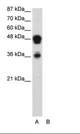 FOXA1 Antibody - A: Marker, B: Transfected 293T Cell Lysate.  This image was taken for the unconjugated form of this product. Other forms have not been tested.