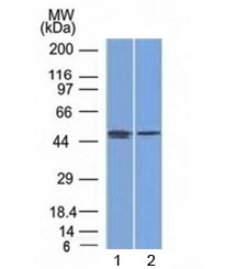 FOXA1 Antibody - Western blot testing of human 1) MCF7 (breast) and 2) PC3 (prostate) cell lysate with FOXA1 antibody (clone FOXA1/1512). Predicted molecular weight: ~49 kDa.