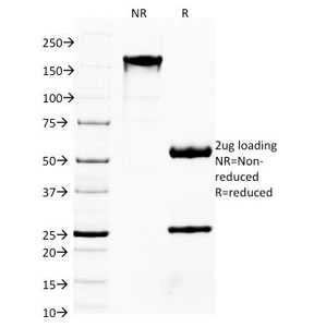 FOXA1 Antibody - SDS-PAGE Analysis of Purified, BSA-Free FOXA1 Antibody (clone FOXA1/1514). Confirmation of Integrity and Purity of the Antibody.