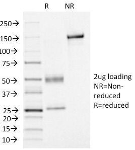 FOXA1 Antibody - SDS-PAGE Analysis of Purified, BSA-Free FOXA1 Antibody (clone FOXA1/1515). Confirmation of Integrity and Purity of the Antibody.