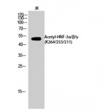FOXA1 + FOXA2 + FOXA3 Antibody - Western blot of Acetyl-HNF-3alpha/beta/gamma (K264/253/211) antibody
