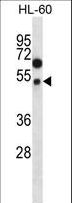 FOXA2 Antibody - FOXA2 Antibody (pT156) western blot of HL-60 cell line lysates (35 ug/lane). The FOXA2 antibody detected the FOXA2 protein (arrow).