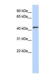 FOXA2 Antibody - FOXA2 antibody Western blot of HeLa lysate. This image was taken for the unconjugated form of this product. Other forms have not been tested.