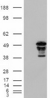 FOXA2 Antibody - HEK293T cells were transfected with the pCMV6-ENTRY control (Left lane) or pCMV6-ENTRY FOXA2 (Right lane) cDNA for 48 hrs and lysed. Equivalent amounts of cell lysates (5 ug per lane) were separated by SDS-PAGE and immunoblotted with anti-FOXA2.