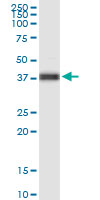 FOXA2 Antibody - FOXA2 monoclonal antibody (M07), clone 4C2. Western blot of FOXA2 expression in human pancreas.