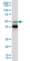 FOXA2 Antibody - FOXA2 monoclonal antibody (M09), clone 4C5 Western blot of FOXA2 expression in HepG2.