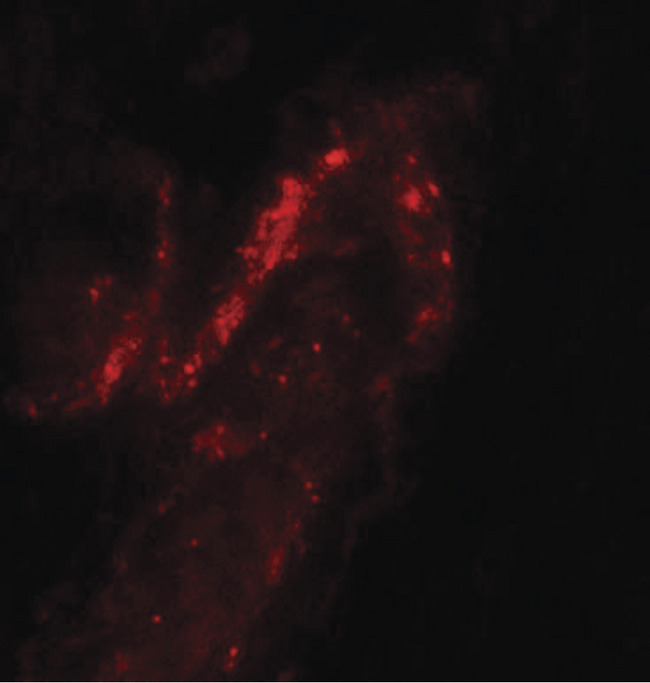 FOXA2 Antibody - Immunofluorescence of FOXA2 in human bladder tissue with FOXA2 antibody at 20 ug/ml.