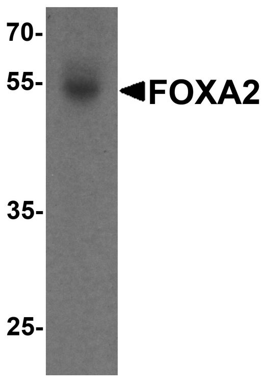 FOXA2 Antibody - Western blot analysis of FOXA2 in human bladder tissue lysate with FOXA2 antibody at 1 ug/ml.