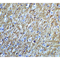 FOXA2 Antibody - Immunohistochemistry of FOXA2 in mouse brain tissue with FOXA2 Antibodyat 5 µg/mL.