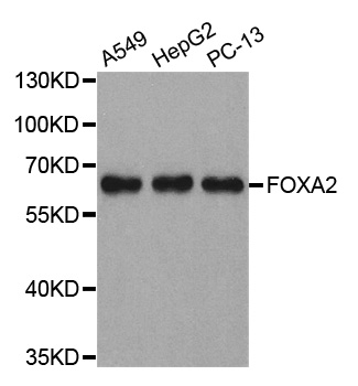 FOXA2 Antibody - Western blot analysis of extracts of various cell lines, using FOXA2 antibody.