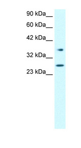 FOXA3 Antibody - FOXA3 antibody Western blot of Jurkat lysate. This image was taken for the unconjugated form of this product. Other forms have not been tested.