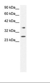 FOXA3 Antibody - Jurkat Cell Lysate.  This image was taken for the unconjugated form of this product. Other forms have not been tested.