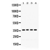 FOXA3 Antibody - FOXA3 antibody Western blot. All lanes: Anti FOXA3 at 0.5 ug/ml. Lane 1: Rat Liver Tissue Lysate at 50 ug. Lane 2: Rat Pancreas Tissue Lysate at 50 ug. Lane 3: Mouse Liver Tissue Lysate at 50 ug. Lane 4: HELA Whole Cell Lysate at 40 ug. Predicted band size: 37 kD. Observed band size: 37 kD.