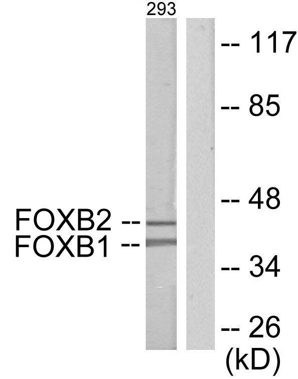 FOXB1+2 Antibody - Western blot analysis of lysates from 293 cells, using FOXB1/2 Antibody. The lane on the right is blocked with the synthesized peptide.
