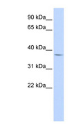 FOXB1 Antibody - FOXB1 antibody Western blot of Fetal Heart lysate. This image was taken for the unconjugated form of this product. Other forms have not been tested.