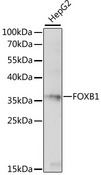 FOXB1 Antibody - Western blot analysis of extracts of HepG2 cells, using FOXB1 antibody at 1:1000 dilution. The secondary antibody used was an HRP Goat Anti-Rabbit IgG (H+L) at 1:10000 dilution. Lysates were loaded 25ug per lane and 3% nonfat dry milk in TBST was used for blocking. An ECL Kit was used for detection and the exposure time was 30s.