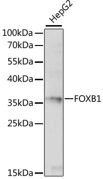FOXB1 Antibody - Western blot analysis of extracts of HepG2 cells using FOXB1 Polyclonal Antibody at dilution of 1:1000.