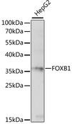 FOXB1 Antibody - Western blot analysis of extracts of HepG2 cells using FOXB1 Polyclonal Antibody at dilution of 1:1000.
