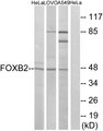 FOXB2 Antibody - Western blot analysis of lysates from HeLa, LOVO, and A549 cells, using FOXB2 Antibody. The lane on the right is blocked with the synthesized peptide.