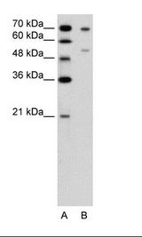 FOXB2 Antibody - A: Marker, B: Jurkat Cell Lysate.  This image was taken for the unconjugated form of this product. Other forms have not been tested.
