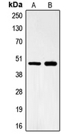 FOXB2 Antibody - Western blot analysis of FOXB2 expression in Lovo (A); HeLa (B) whole cell lysates.