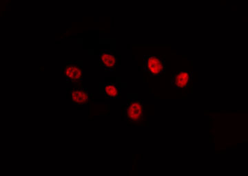 FOXB2 Antibody - Staining HepG2 cells by IF/ICC. The samples were fixed with PFA and permeabilized in 0.1% Triton X-100, then blocked in 10% serum for 45 min at 25°C. The primary antibody was diluted at 1:200 and incubated with the sample for 1 hour at 37°C. An Alexa Fluor 594 conjugated goat anti-rabbit IgG (H+L) Ab, diluted at 1/600, was used as the secondary antibody.