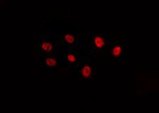 FOXB2 Antibody - Staining HepG2 cells by IF/ICC. The samples were fixed with PFA and permeabilized in 0.1% Triton X-100, then blocked in 10% serum for 45 min at 25°C. The primary antibody was diluted at 1:200 and incubated with the sample for 1 hour at 37°C. An Alexa Fluor 594 conjugated goat anti-rabbit IgG (H+L) Ab, diluted at 1/600, was used as the secondary antibody.