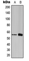FOXC1+2 Antibody - Western blot analysis of FOXC1/2 expression in THP1 (A); RAW264.7 (B) whole cell lysates.