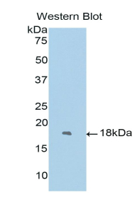 FOXC1 Antibody - Western blot of recombinant FOXC1.  This image was taken for the unconjugated form of this product. Other forms have not been tested.