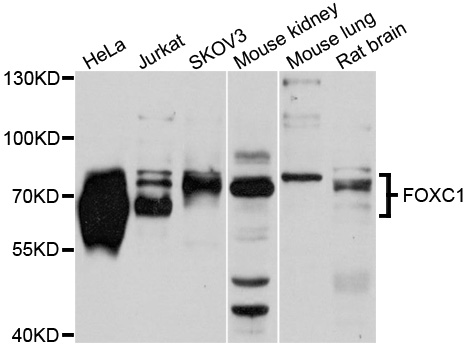 FOXC1 Antibody - Western blot analysis of extracts of various cells.