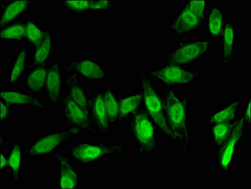 FOXC1 Antibody - Immunofluorescent analysis of Hela cells using FOXC1 Antibody at a dilution of 1:100 and Alexa Fluor 488-congugated AffiniPure Goat Anti-Rabbit IgG(H+L)