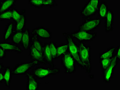 FOXC1 Antibody - Immunofluorescent analysis of Hela cells using FOXC1 Antibody at dilution of 1:100 and Alexa Fluor 488-congugated AffiniPure Goat Anti-Rabbit IgG(H+L)