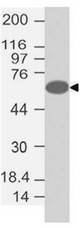 FOXC1 Antibody - Fig-1: Western blot analysis of FOXC1. Anti-FOXC1 antibody was used at 0.5 µg/ml on MCF-7 lysate.