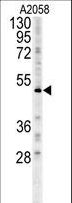 FOXC2 Antibody - FOXC2 Antibody (Center S174) western blot of A2058 cell line lysates (15 ug/lane). The FOXC2 antibody detected the FOXC2 protein (arrow).