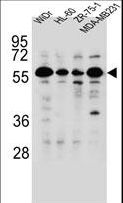 FOXC2 Antibody - FOXC2 Antibody (Center P198) western blot of WiDr,HL-60,ZR-75-1,MDA-MB231 cell line lysates (35 ug/lane). The FOXC2 antibody detected the FOXC2 protein (arrow).