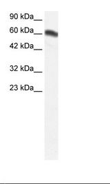 FOXC2 Antibody - Fetal Kidney Lysate.  This image was taken for the unconjugated form of this product. Other forms have not been tested.