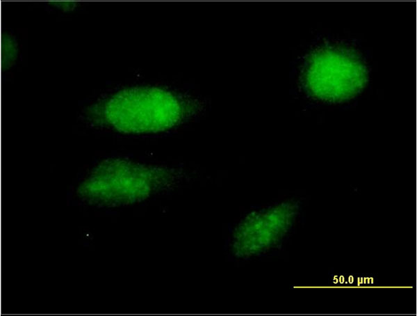 FOXC2 Antibody - Immunofluorescence of monoclonal antibody to FOXC2 on HeLa cell (antibody concentration 10 ug/ml).