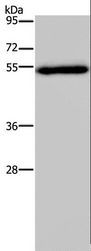 FOXC2 Antibody - Western blot analysis of Human breast infiltrative duct tissue, using FOXC2 Polyclonal Antibody at dilution of 1:833.