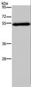 FOXC2 Antibody - Western blot analysis of Human breast infiltrative duct tissue, using FOXC2 Polyclonal Antibody at dilution of 1:833.