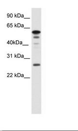 FOXD1 Antibody - SP2/0 Cell Lysate.  This image was taken for the unconjugated form of this product. Other forms have not been tested.