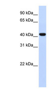 FOXD1 Antibody - FOXD1 antibody Western blot of Fetal Lung lysate. This image was taken for the unconjugated form of this product. Other forms have not been tested.