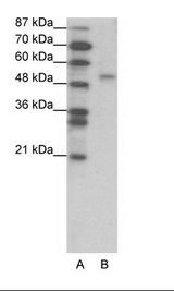 FOXD2 Antibody - A: Marker, B: Jurkat Cell Lysate.  This image was taken for the unconjugated form of this product. Other forms have not been tested.