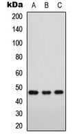 FOXD3 Antibody - Western blot analysis of FOXD3 expression in Jurkat (A); K562 (B); NIH3T3 (C) whole cell lysates.