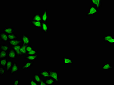FOXD3 Antibody - Immunofluorescence staining of Hela cells with FOXD3 Antibody at 1:133, counter-stained with DAPI. The cells were fixed in 4% formaldehyde, permeabilized using 0.2% Triton X-100 and blocked in 10% normal Goat Serum. The cells were then incubated with the antibody overnight at 4°C. The secondary antibody was Alexa Fluor 488-congugated AffiniPure Goat Anti-Rabbit IgG(H+L).