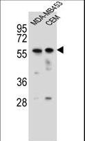FOXD4 Antibody - FOXD4 Antibody western blot of MDA-MB453,CEM cell line lysates (35 ug/lane). The FOXD4 antibody detected the FOXD4 protein (arrow).