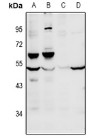 FOXD4 Antibody - Western blot analysis of FOXD4 expression in H1792 (A), A549 (B), PC12 (C), MEF (D) whole cell lysates.