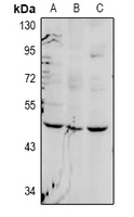 FOXD4 Antibody - Western blot analysis of FOXD4 expression in H9C2 (A), AML12 (B), HepG2 (C) whole cell lysates.