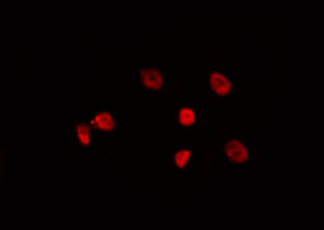 FOXD4 Antibody - Staining HeLa cells by IF/ICC. The samples were fixed with PFA and permeabilized in 0.1% Triton X-100, then blocked in 10% serum for 45 min at 25°C. The primary antibody was diluted at 1:200 and incubated with the sample for 1 hour at 37°C. An Alexa Fluor 594 conjugated goat anti-rabbit IgG (H+L) Ab, diluted at 1/600, was used as the secondary antibody.