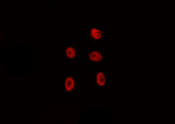 FOXD4 Antibody - Staining HepG2 cells by IF/ICC. The samples were fixed with PFA and permeabilized in 0.1% Triton X-100, then blocked in 10% serum for 45 min at 25°C. The primary antibody was diluted at 1:200 and incubated with the sample for 1 hour at 37°C. An Alexa Fluor 594 conjugated goat anti-rabbit IgG (H+L) Ab, diluted at 1/600, was used as the secondary antibody.